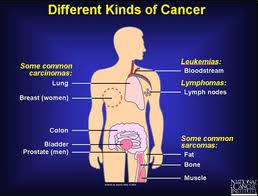 Different Types of Cancer